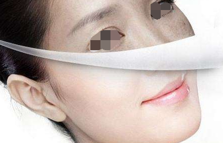 哪种方法美白最有效呢