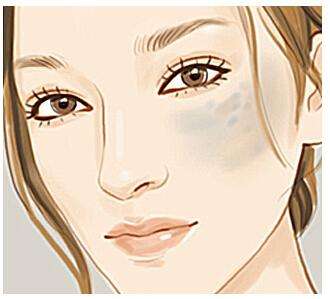 激光能治疗脸上太田痣吗