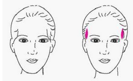 自体脂肪丰太阳穴的价格