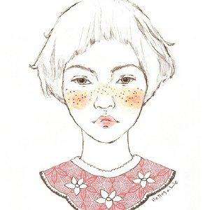 激光祛痘印效果好不好