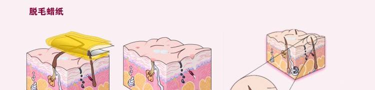 腿部脱毛哪种方法较好