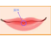 唇珠成形术后要注意哪些
