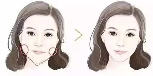 艺星瘦脸