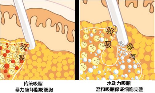 瘦腿有什么快捷有效的方法吗?