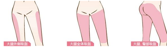 瘦腿有什么快捷有效的方法吗?