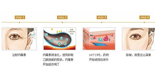 除皱原理