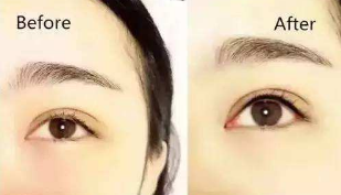美瞳线