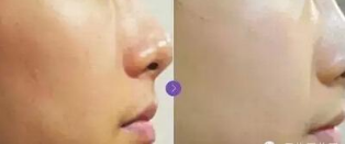 艺星水光效果对比图