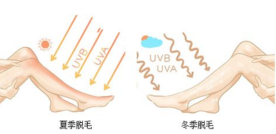 冬季脱毛的好处
