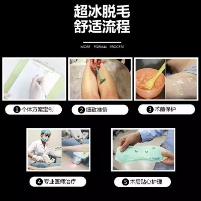冰点脱毛的流程
