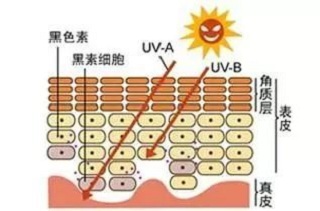 黑色素沉积