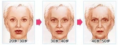 胶原蛋白随年龄流失