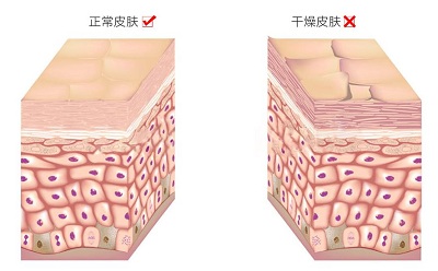 皮肤干燥治不好
