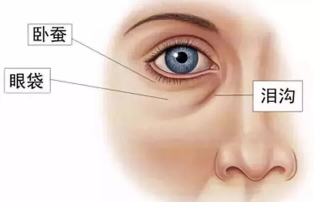 眼袋卧蚕傻傻分不清