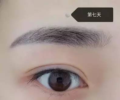 纹眉一周恢复自然