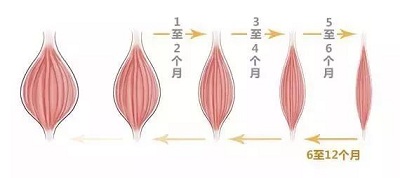 除皱原理