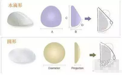 隆胸假体的各种形状
