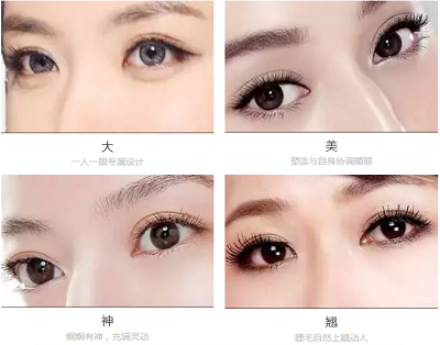 艺星双眼皮四大特点