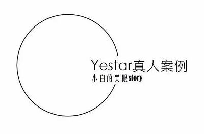 艺星双眼皮真人案例