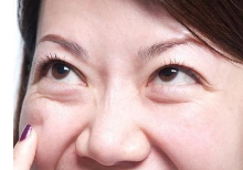 眼袋