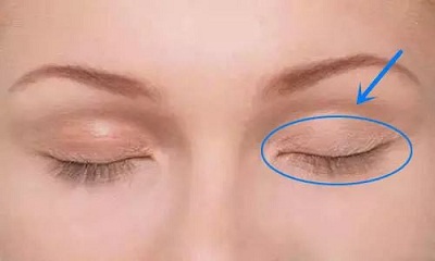 双眼皮贴贴多了显老