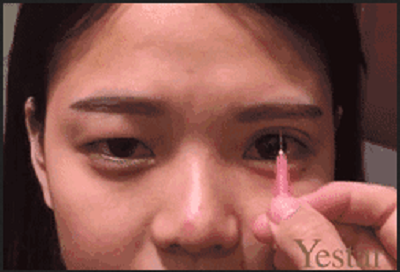 个双眼皮设计精细