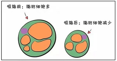 减少脂肪数量