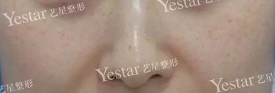 拉近看斑纹多