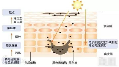 祛斑没有这么容易