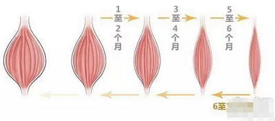 除皱的原理示意