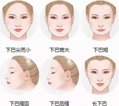 下巴不好看该怎么办