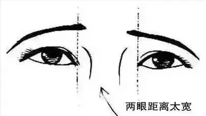 眼间距太宽眼睛不好看