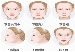 各种下巴的缺陷问题