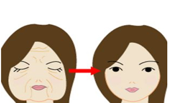 去除眼周皱纹显年轻
