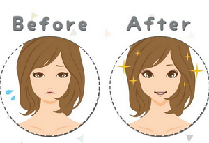 垫下巴的方法玻尿酸