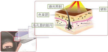 黑脸娃娃美白的原理过程