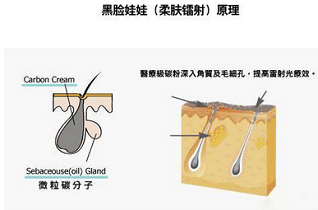 黑脸娃娃美白嫩肤的过程