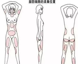 自体脂肪移植取哪的脂肪