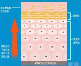 果酸换肤是什么有什么用