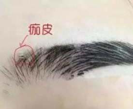 纹眉后要注意什么