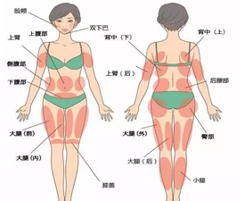 吸脂减掉小肚腩