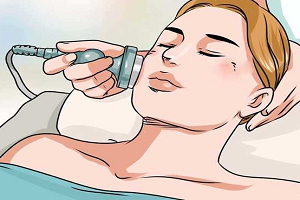 医美激光项目都有哪些