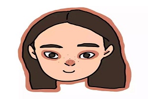 假体隆鼻
