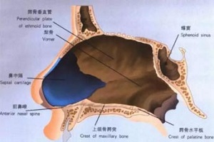 什么是鼻中隔整形，鼻中隔整形的效果怎么样?