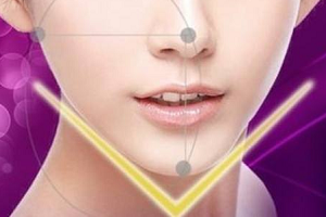 上海垫下巴有哪些方法