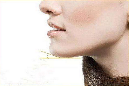 医美下巴整形的方法都是什么?有何不同?