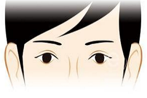 上海三角眼矫正