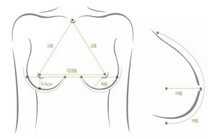 乳晕缩小术后会导致畸形吗?