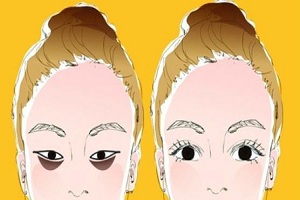 去除黑眼圈的方法