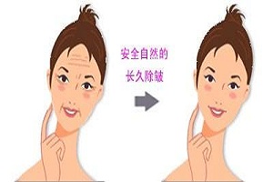 电波拉皮术后需要注意什么呢